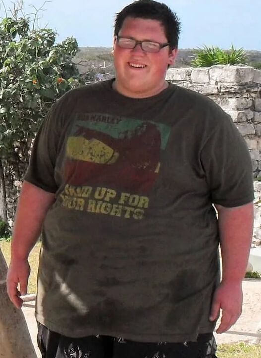 Nadváha pred použitím keto probiotixu